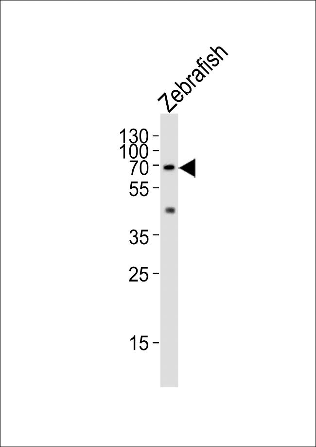 L-Plastin Antibody in Western Blot (WB)