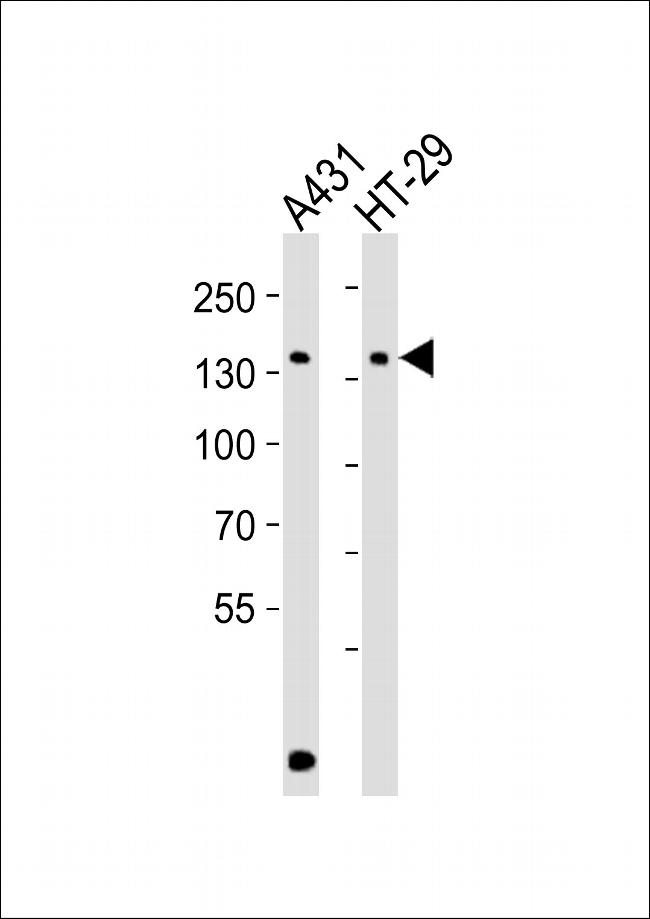 CTR9 Antibody in Western Blot (WB)