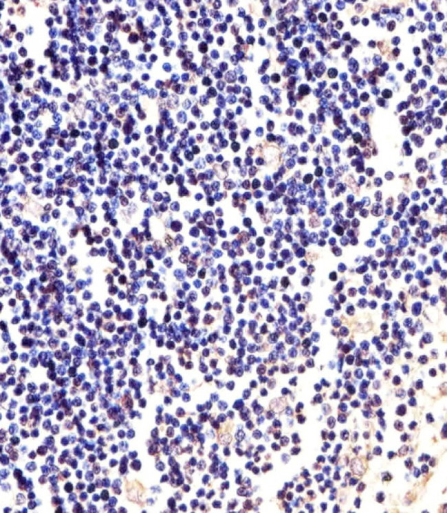 ANAPC2 Antibody in Immunohistochemistry (Paraffin) (IHC (P))