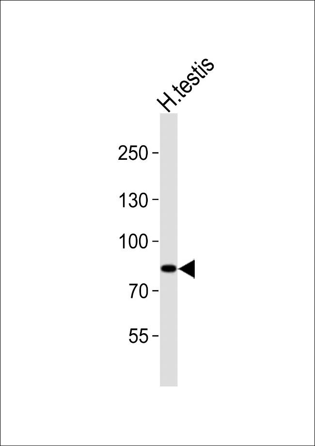 ANAPC2 Antibody in Western Blot (WB)