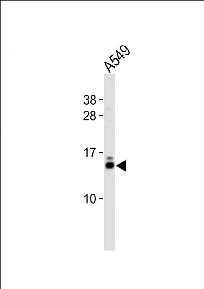 eIF1 Antibody in Western Blot (WB)