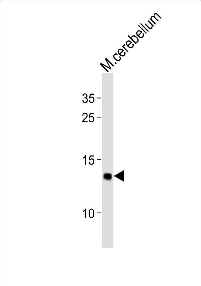 eIF1 Antibody in Western Blot (WB)