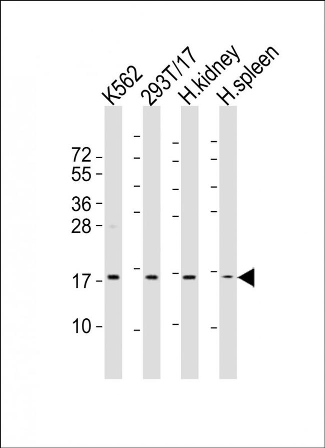 NFE4 Antibody in Western Blot (WB)