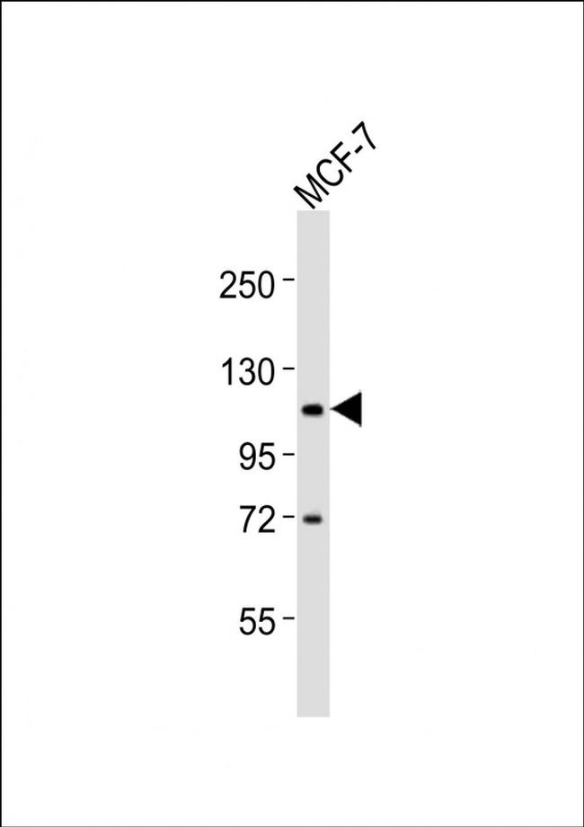 ADAMTS15 Antibody in Western Blot (WB)