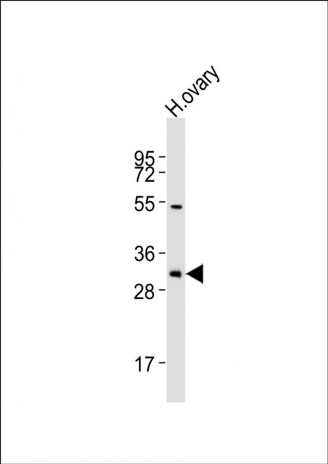 NBPF12 Antibody in Western Blot (WB)