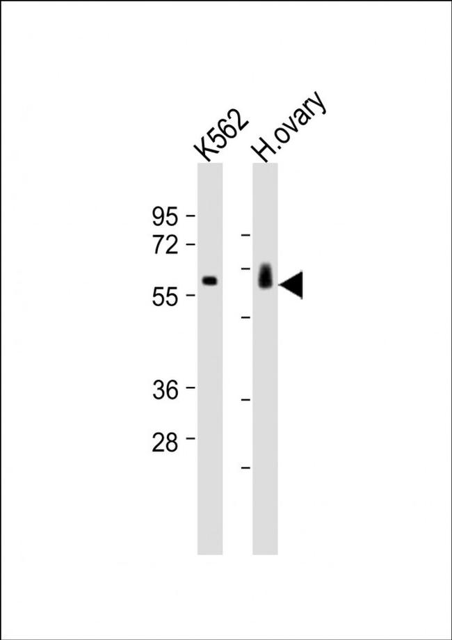 C17orf80 Antibody in Western Blot (WB)