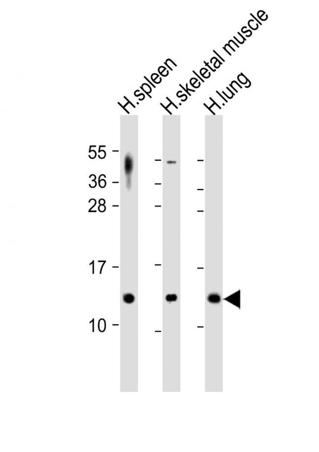 TARC Antibody in Western Blot (WB)