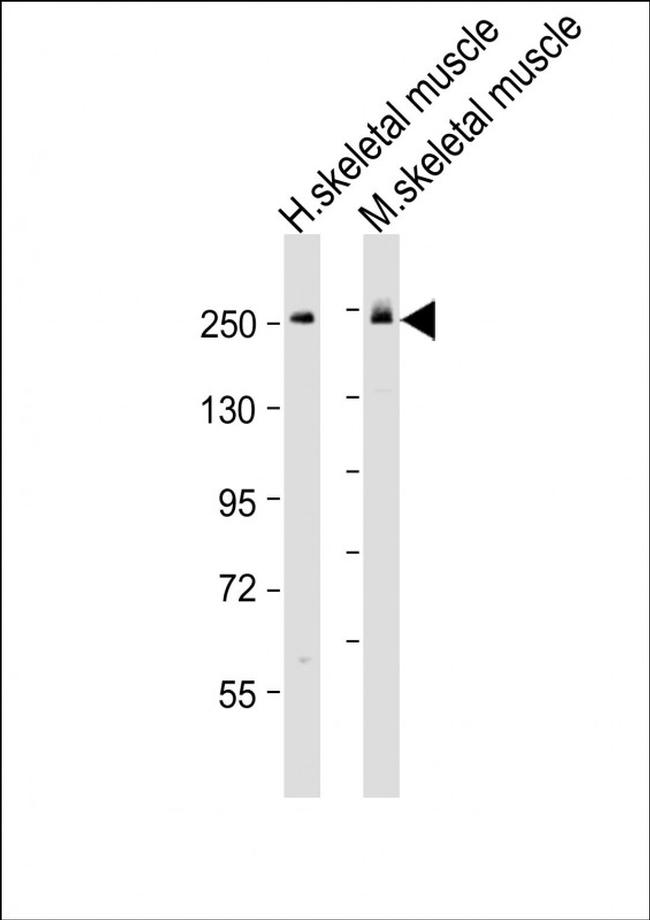 MYH6 Antibody in Western Blot (WB)