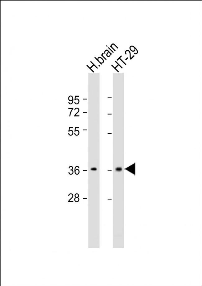 OR2T7 Antibody in Western Blot (WB)