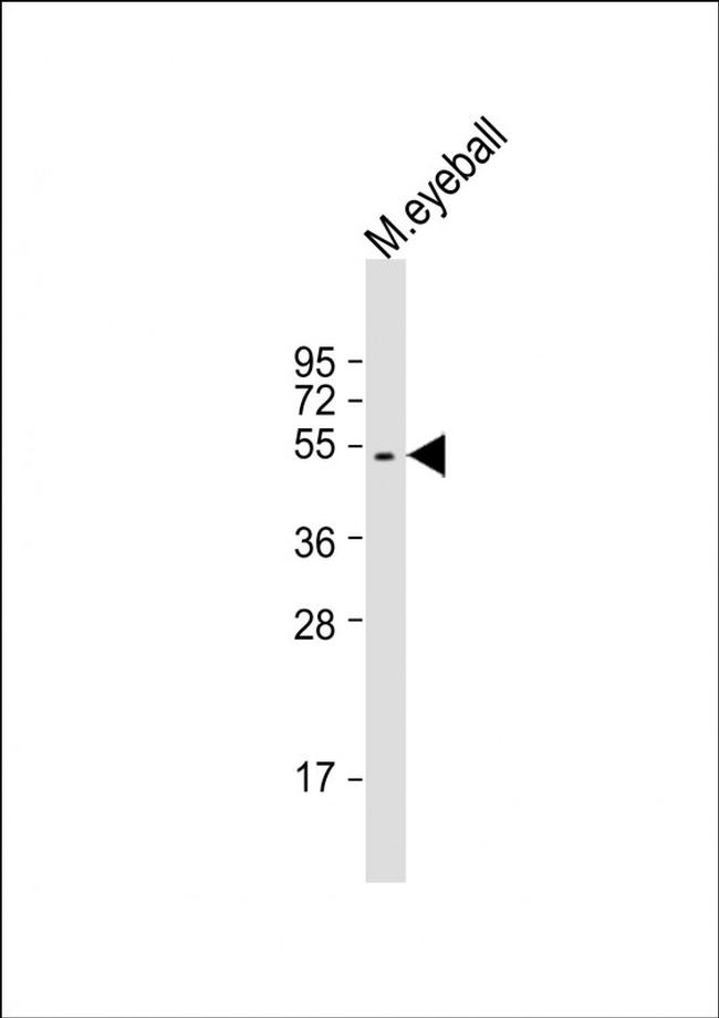 S-arrestin Antibody in Western Blot (WB)