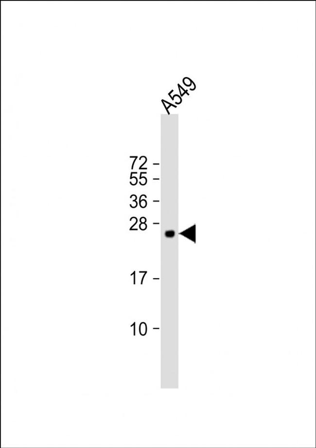 PUMA delta/gamma Antibody in Western Blot (WB)