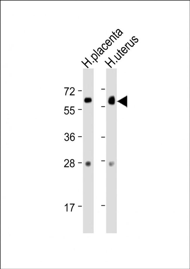 ZBTB7C Antibody in Western Blot (WB)