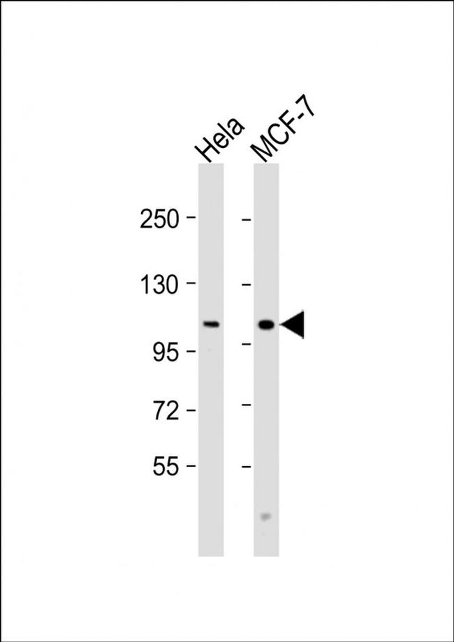 VLDLR Antibody in Western Blot (WB)