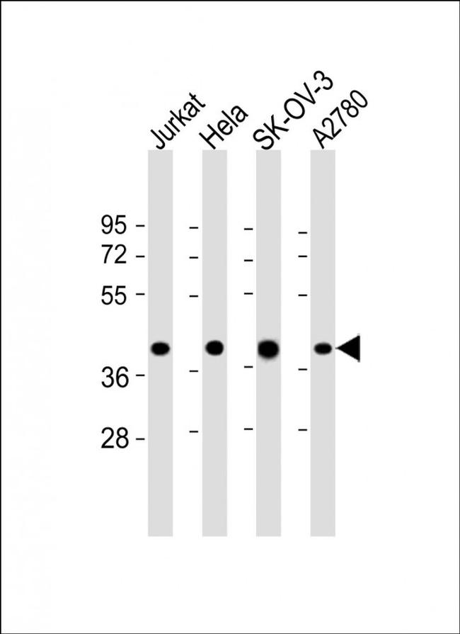 GBGT1 Antibody in Western Blot (WB)