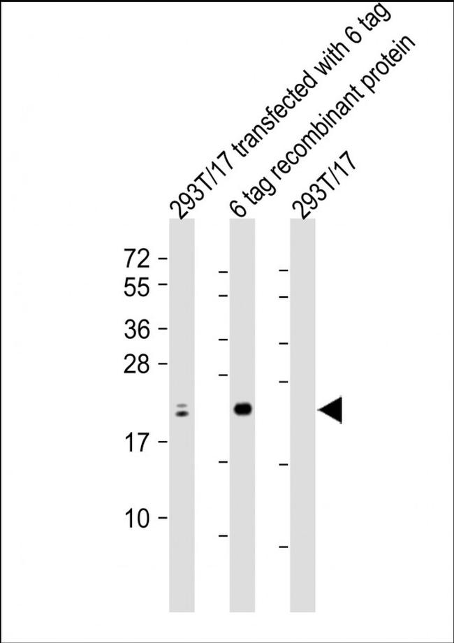 S1 tag Antibody in Western Blot (WB)