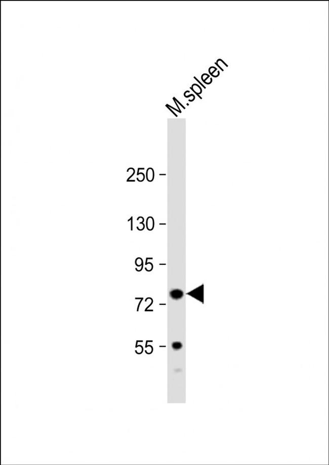 Kindlin 3 Antibody in Western Blot (WB)