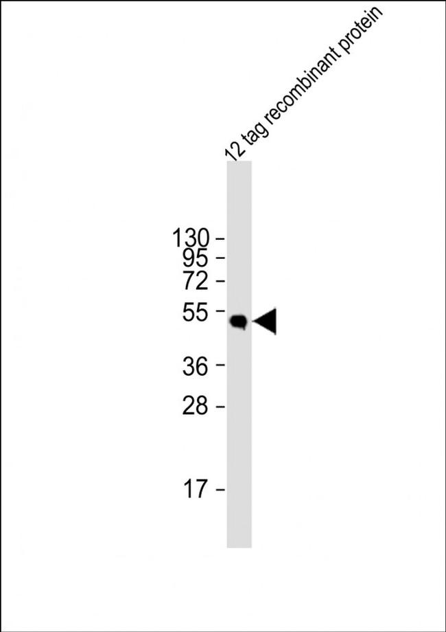 HSV Tag Antibody in Western Blot (WB)