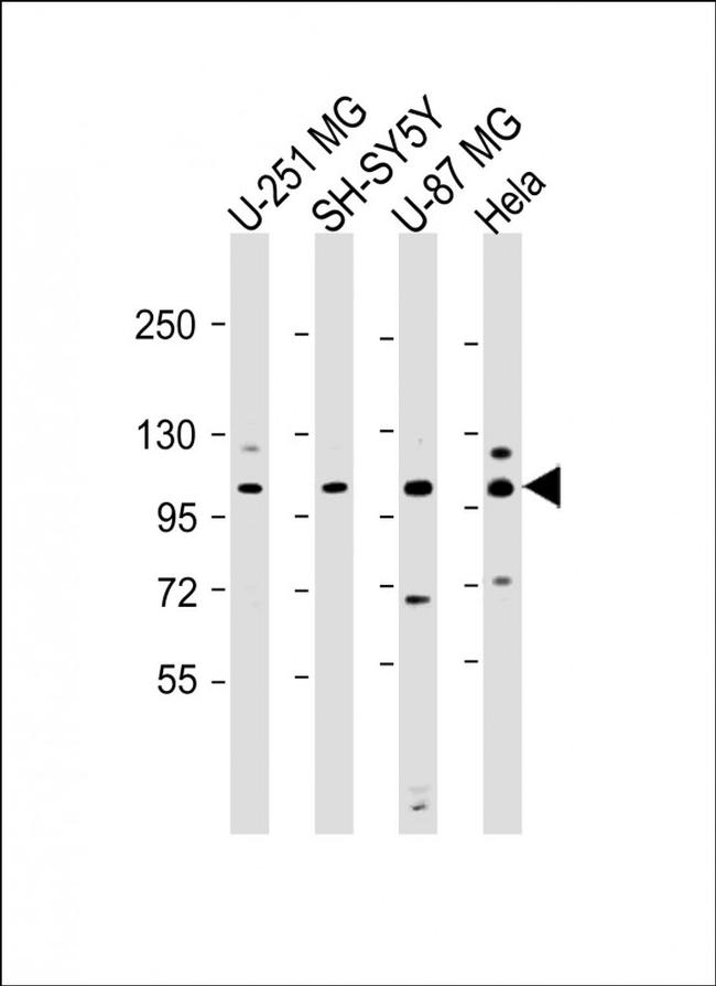 SH3PXD2B Antibody in Western Blot (WB)