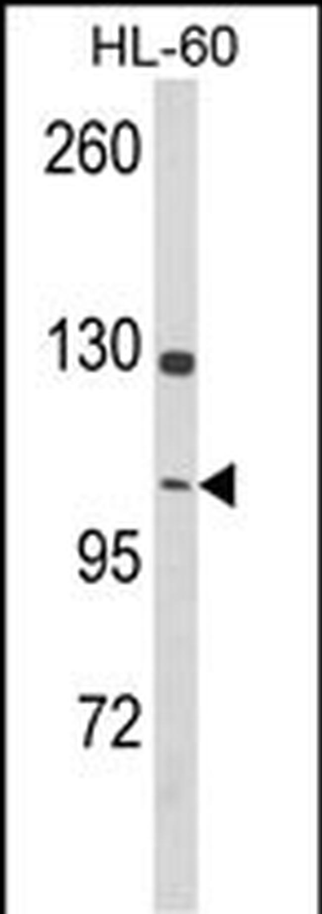 Dynamin 3 Antibody in Western Blot (WB)