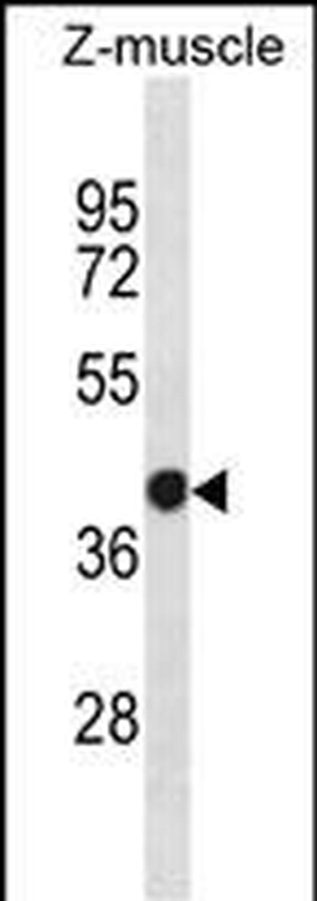 EIF2S1 Antibody in Western Blot (WB)