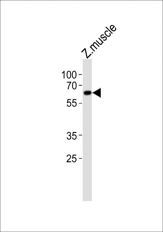 EDC3 Antibody in Western Blot (WB)