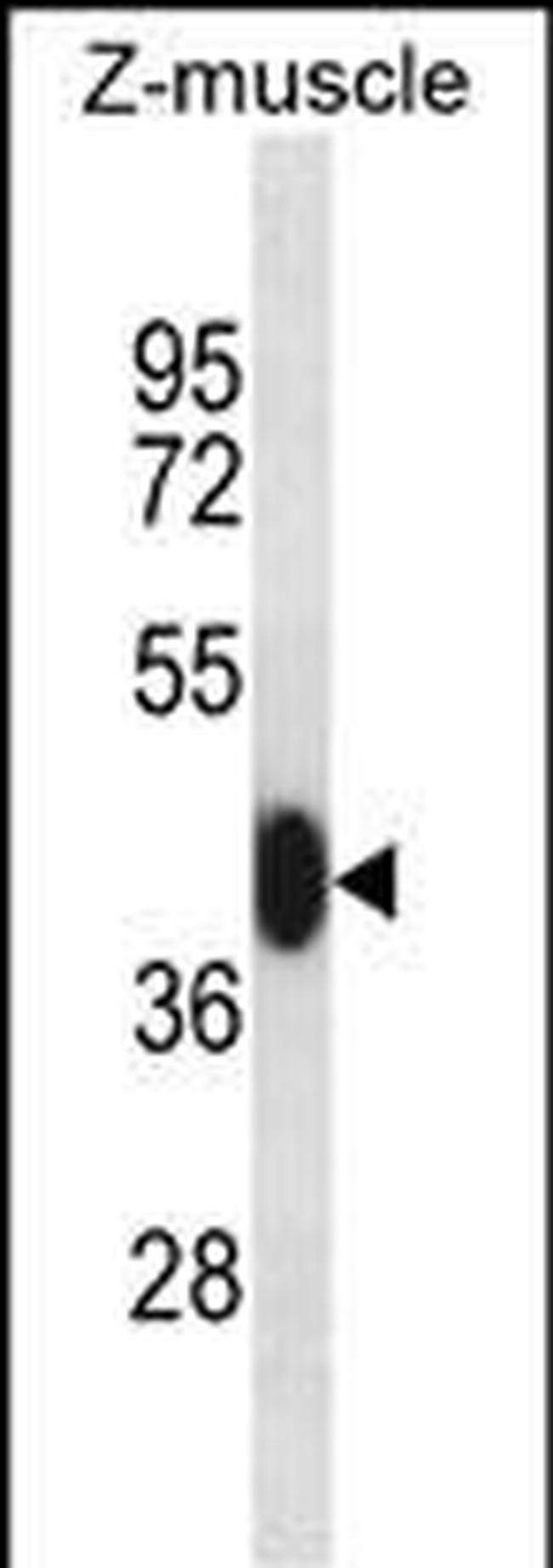 MEF2C Antibody in Western Blot (WB)