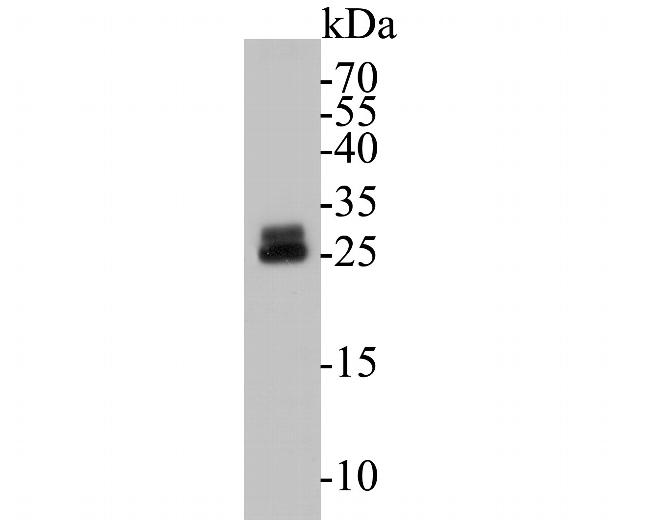 RBPMS Antibody in Western Blot (WB)