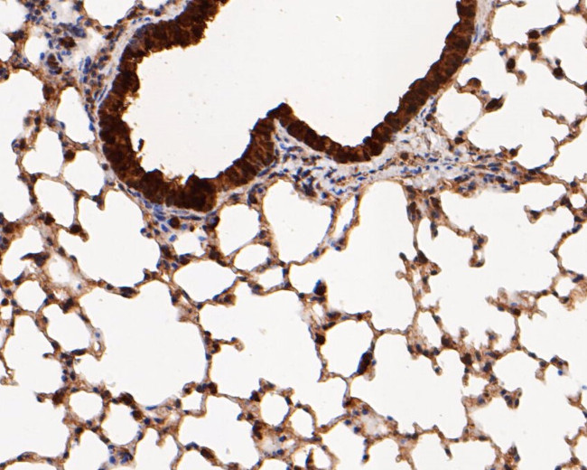 MTAP Antibody in Immunohistochemistry (Paraffin) (IHC (P))