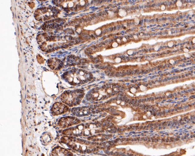 MTAP Antibody in Immunohistochemistry (Paraffin) (IHC (P))