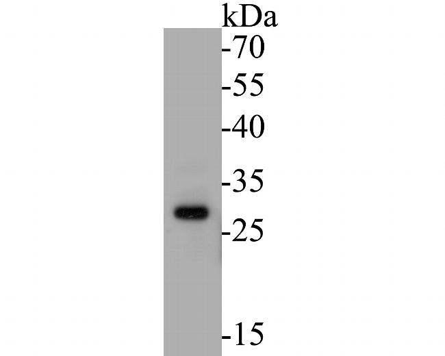 MTAP Antibody in Western Blot (WB)