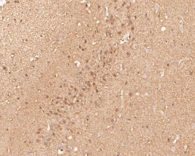 P2X6 Antibody in Immunohistochemistry (Paraffin) (IHC (P))