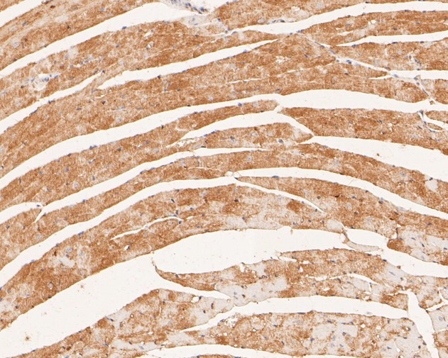 P2X6 Antibody in Immunohistochemistry (Paraffin) (IHC (P))