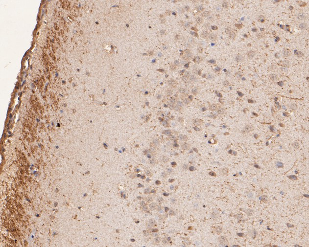 GABRA4 Antibody in Immunohistochemistry (Paraffin) (IHC (P))