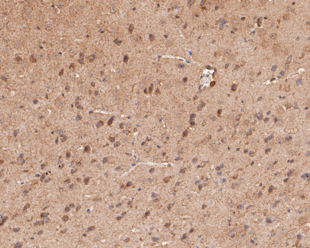 GABRA4 Antibody in Immunohistochemistry (Paraffin) (IHC (P))