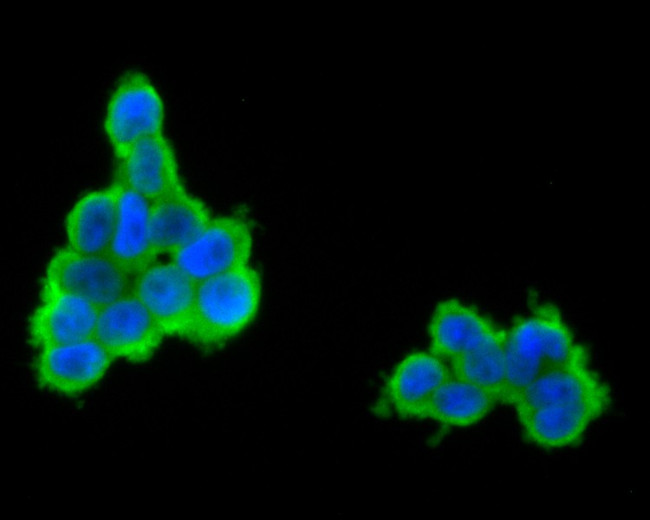 GABRB1 Antibody in Immunocytochemistry (ICC/IF)