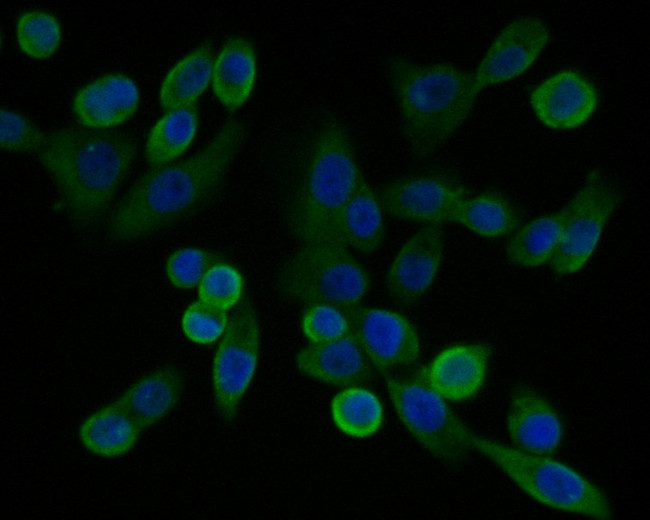 GABRB1 Antibody in Immunocytochemistry (ICC/IF)