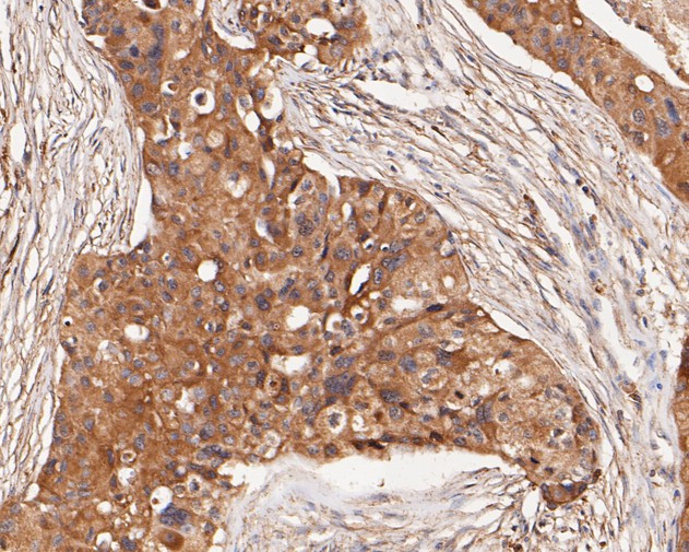 GABRB1 Antibody in Immunohistochemistry (Paraffin) (IHC (P))