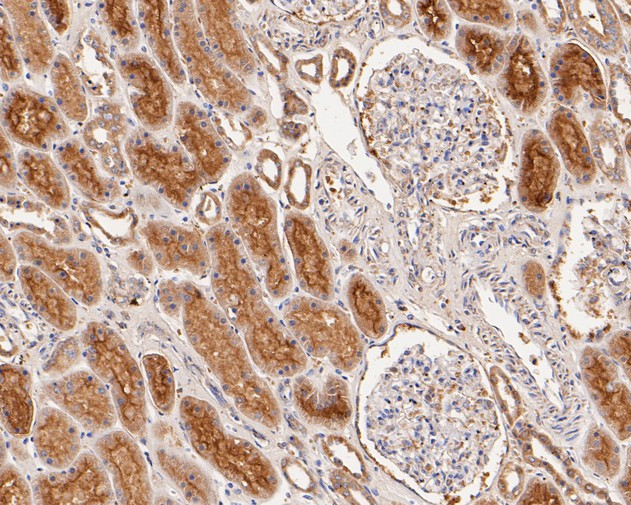 GABRB1 Antibody in Immunohistochemistry (Paraffin) (IHC (P))