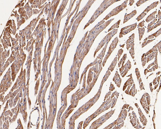 GABRB1 Antibody in Immunohistochemistry (Paraffin) (IHC (P))