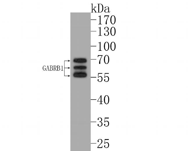 GABRB1 Antibody in Western Blot (WB)