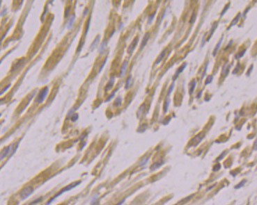 USP21 Antibody in Immunohistochemistry (Paraffin) (IHC (P))