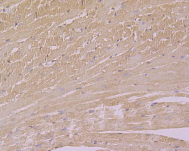 USP21 Antibody in Immunohistochemistry (Paraffin) (IHC (P))