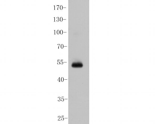 USP21 Antibody in Western Blot (WB)