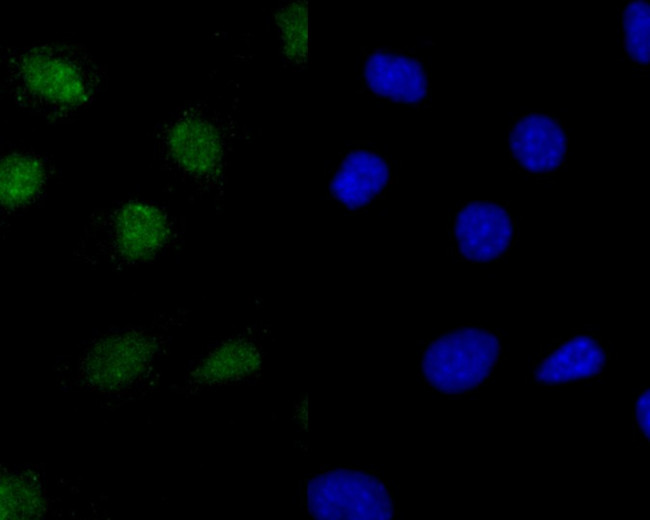 Histone H2A.X Antibody in Immunocytochemistry (ICC/IF)