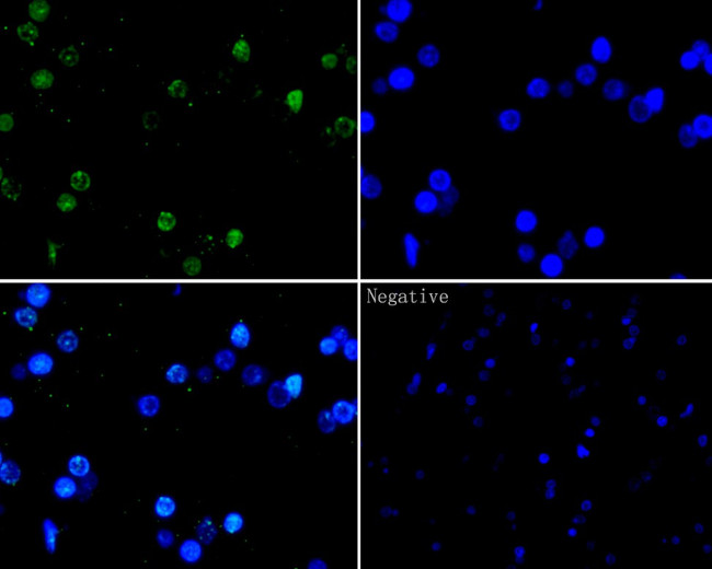 Histone H2A.X Antibody in Immunohistochemistry (Paraffin) (IHC (P))