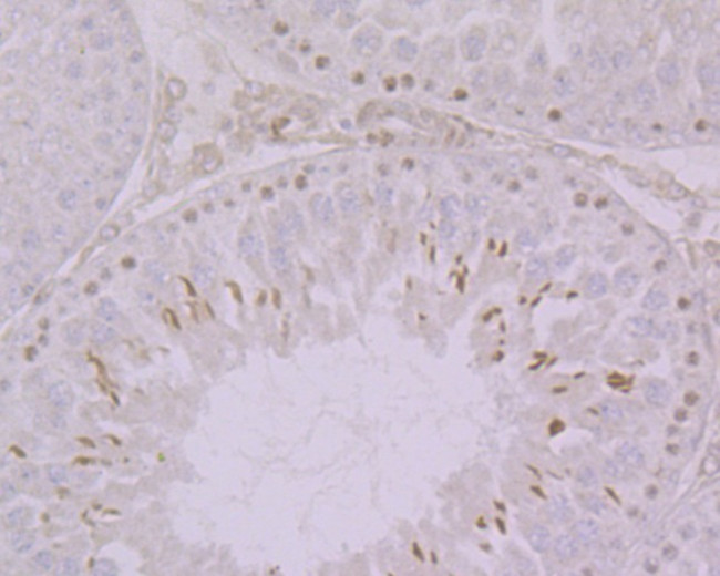 Histone H2A.X Antibody in Immunohistochemistry (Paraffin) (IHC (P))