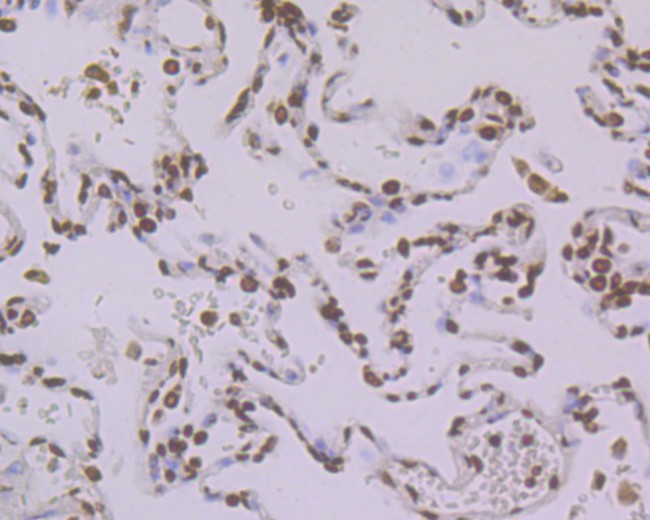 Histone H2A.X Antibody in Immunohistochemistry (Paraffin) (IHC (P))