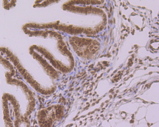 Histone H2A.X Antibody in Immunohistochemistry (Paraffin) (IHC (P))