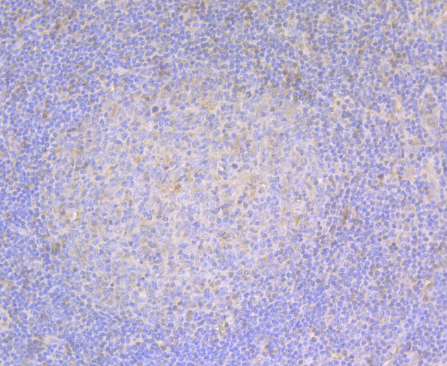 Fascin Antibody in Immunohistochemistry (Paraffin) (IHC (P))