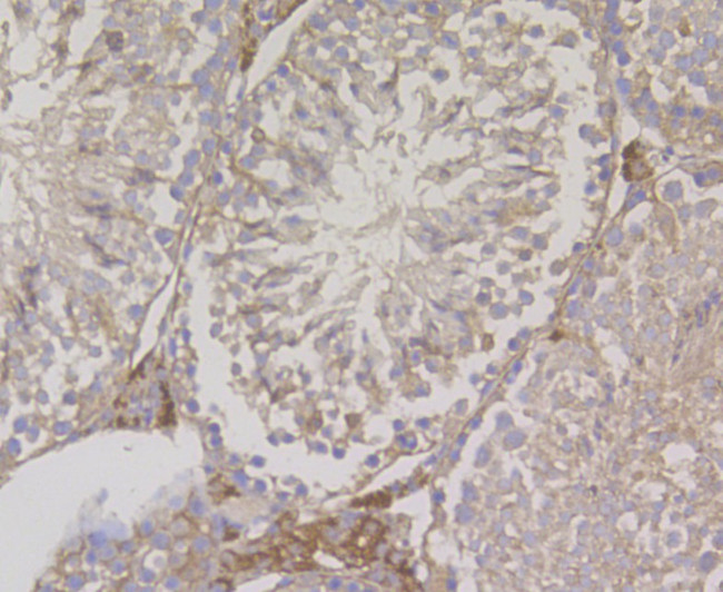 Fascin Antibody in Immunohistochemistry (Paraffin) (IHC (P))